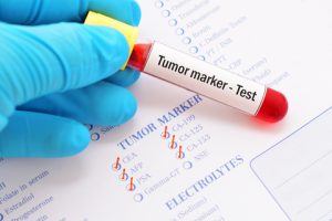 Biomarker cancer